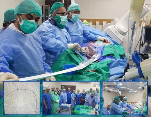 A team of cardiac surgeons, interventional cardiologists and anaesthesiologists marked another first by performing “thoracic endovascular aneurysm repair (a minimally invasive method to treat an abdominal aortic aneurysm) on a 30-year-old man” at the National Institute of Cardiovascular Diseases, Karachi, recently.